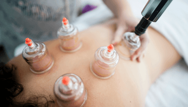 Image for Cupping Massage Therapy